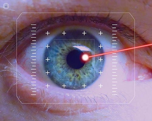 Cómo corregir la miopía, la hipermetropía y el astigmatismo