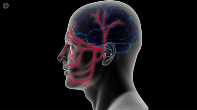 Neuralgia del trigémino: qué es, síntomas y tratamiento | Top Doctors