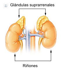 Tumores de las glándulas suprarrenales: qué es, síntomas y tratamiento |  Top Doctors