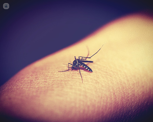 Alergia a picaduras de insectos: qué es, síntomas y tratamiento | Top  Doctors