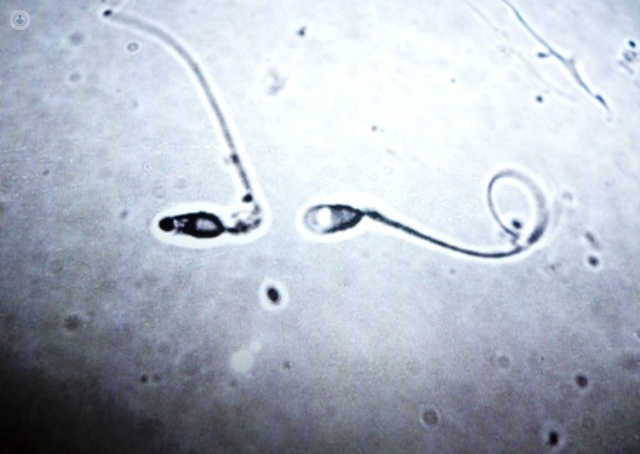 Seminograma: calidad y producción de los espermatozoides