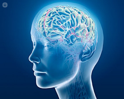 Infografía de un cerebro - análisis detección temprana Alzheimer | by Top Doctors