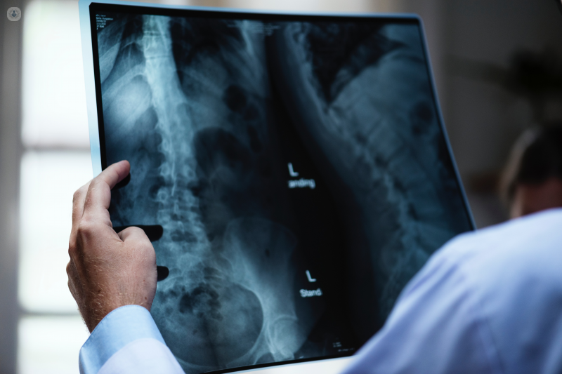 Cómo se realiza una radiografía? | Top Doctors