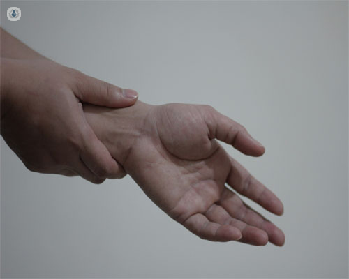 Cuáles son las principales patologías de la mano? | Top Doctors