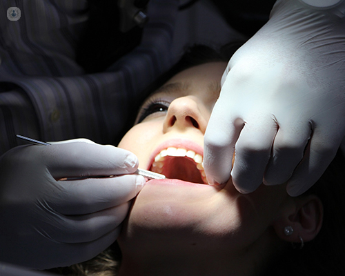 Beneficios del uso del láser en una endodoncia | Top Doctors