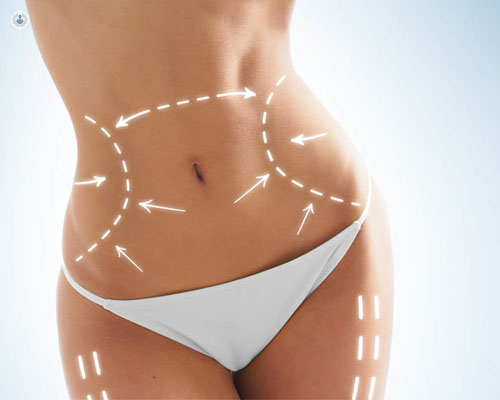 Beneficios de la presoterapia en el abdomen para estética y salud