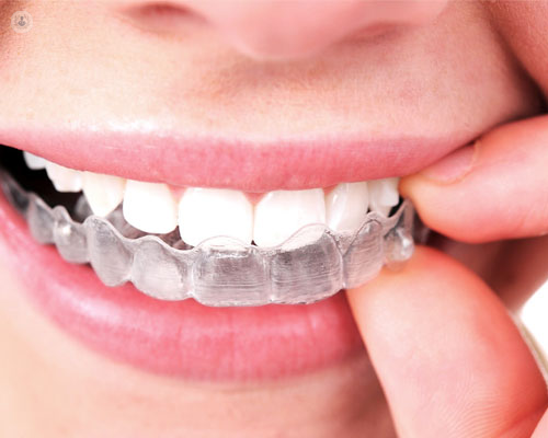 Eficacia de la ortodoncia invisible vs la tradicional? | Top Doctors