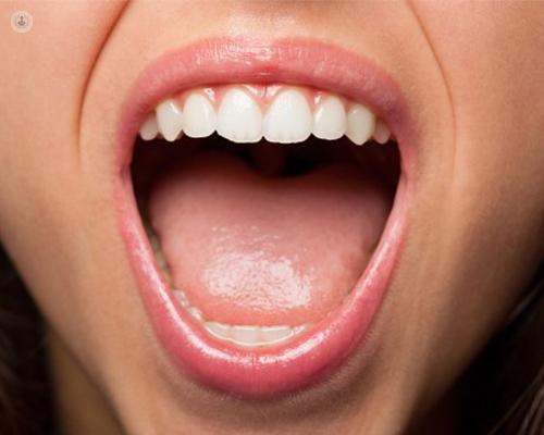 Chica abriendo la boca - leucoplasia oral - by Top Doctors