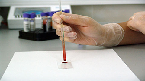 PCR Muestras nasofaríngeas