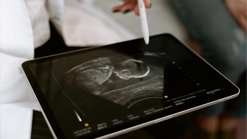 Test prenatal no invasivo Avanzado UNIGEN PLUS 